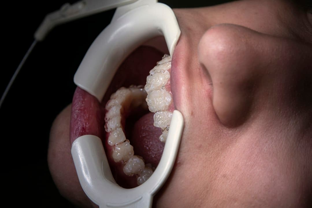 Dental treatment in progress